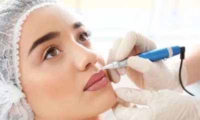 Principles and Treatment Process of IPL